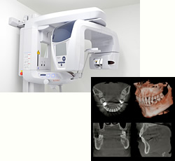 歯科用CT