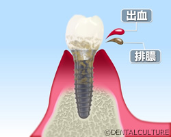 メンテナンスと定期検診