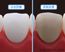 予防歯科とは